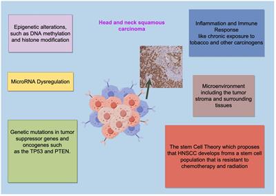 Histone modifications in head and neck squamous cell carcinoma